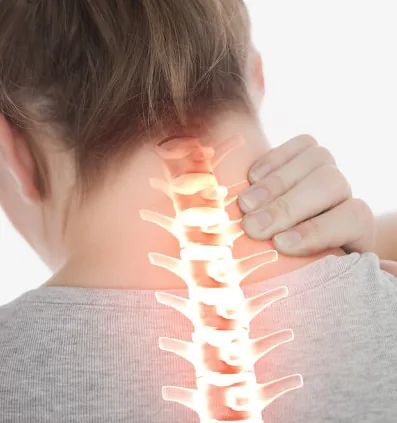 Dolor cervical que se irradia hacia la cabeza